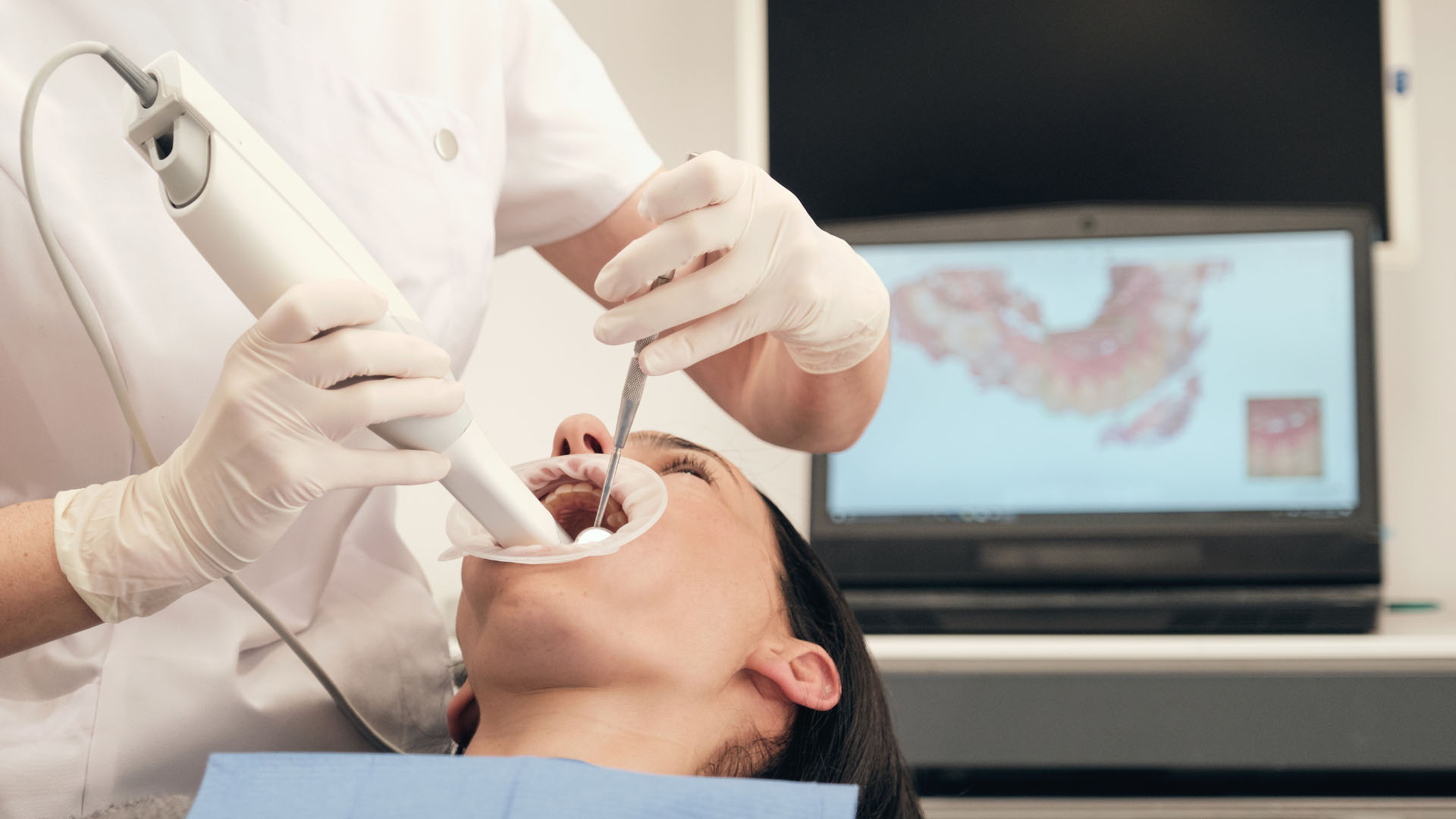 Dentist using an intraoral scanner on a female patient, with a 3D dental scan displayed on a monitor behind them.